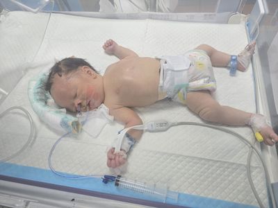 Palestinian Infant Battles the Aftermath of Settler Attack on Family Home in Beit Imrin as Family Lives Daily Nightmare Fearing for His Life