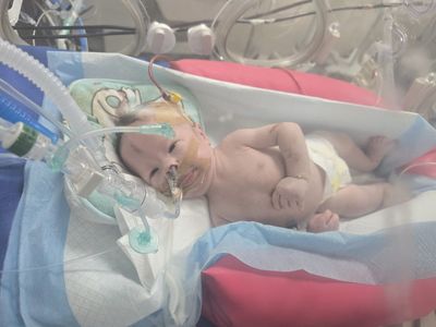 Palestinian Infant Battles Lasting Effects of Settler Attack on Family Home in Beit Imrin as Family Lives in Daily Fear for His Life