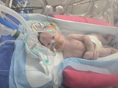 Palestinian Infant Battles Lasting Effects of Settler Attack on Family Home in Beit Imrin as Family Lives in Daily Fear for His Life